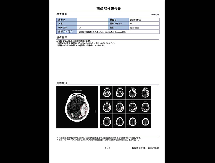 頭部CT×高吸収/低吸収域