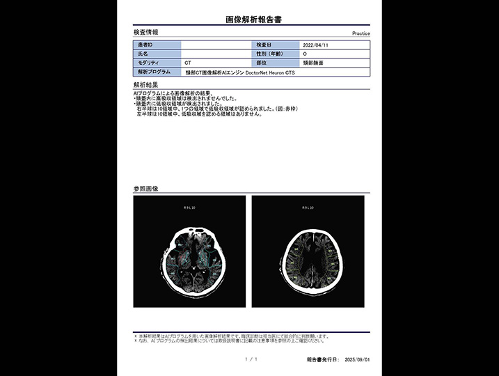 頭部CT×高吸収/低吸収域