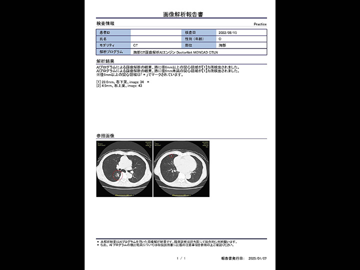 胸部CT×関心領域